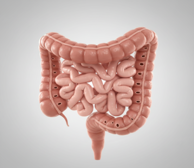 Doença Diverticular do Cólon
